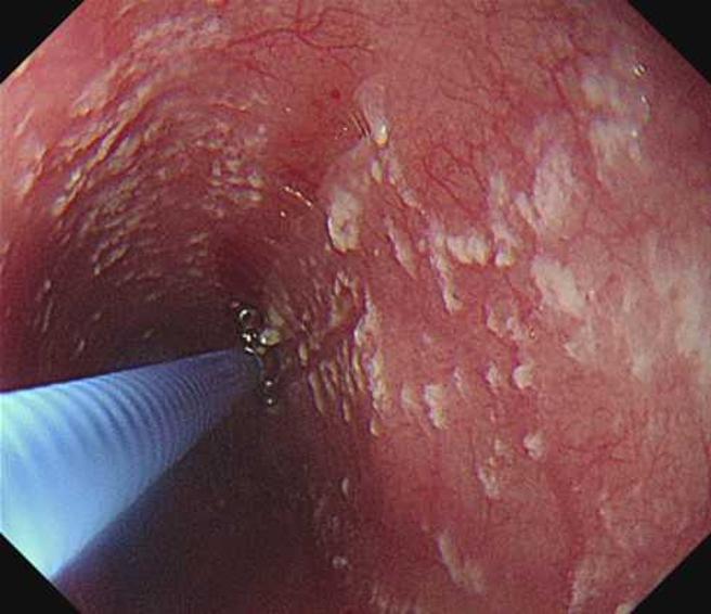 （图／翻摄自肝胆肠胃科 詹宜学医师脸书）