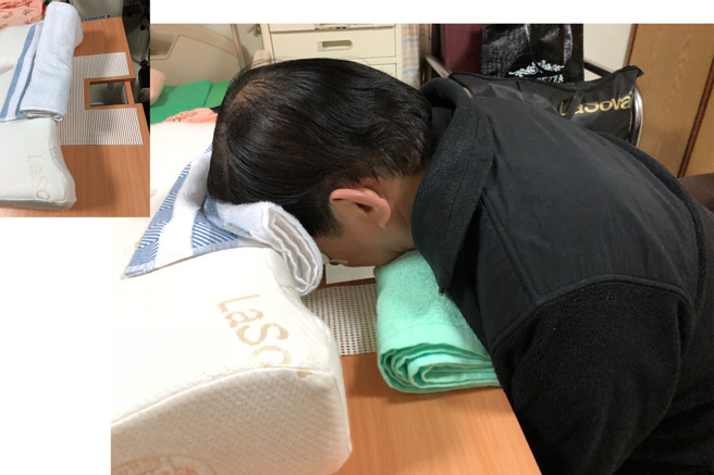 管中闵曾因视网膜剥离开刀，被医师叮嘱要保持「低头」姿势，才能稳定病情。（图／翻摄自管中闵脸书）