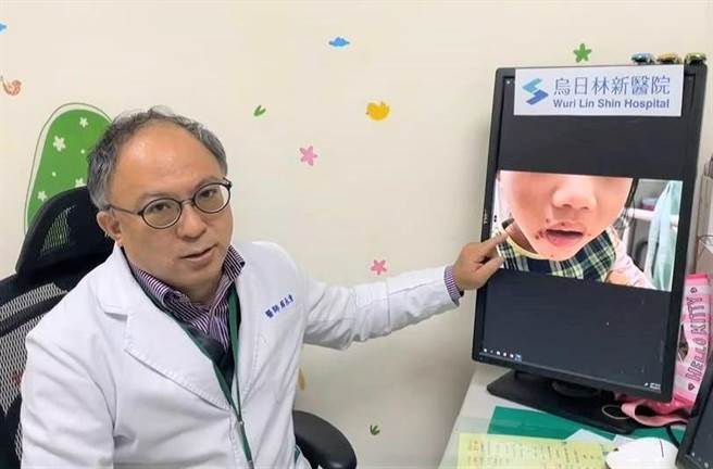 乌日林新医院小儿科医师赖永清指出，由于肠病毒引起的疱疹性咽峡炎与原发性的急性疱疹性齿龈口腔炎症状相似，藉此提醒民眾2者差别，避免错失黄金治疗期。（乌日林新医院提供／潘虹恩台中传真）