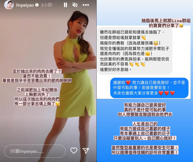林佩瑶透过自身经验鼓励粉丝，勇于做自己。(图/林佩瑶 IG)