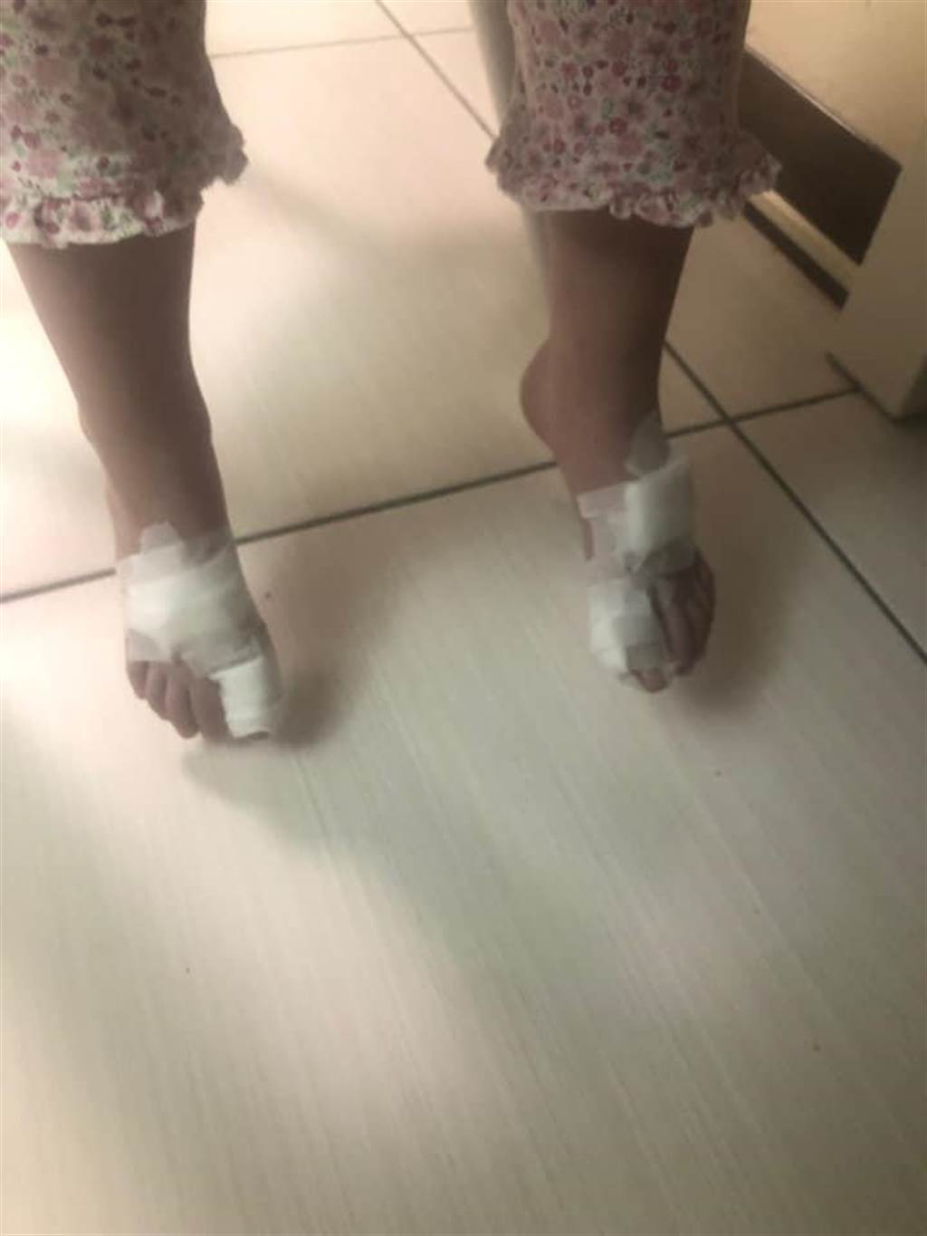 有4歲幼兒到平鎮新勢公園玩耍，2腳都被割傷，讓人看了心疼。(劉仁照提供／蔡依珍桃園傳真)