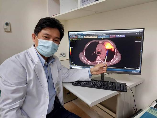 赵刚宏主任提醒民眾，大多数肺癌病人发现时都是晚期，导致存活率较低。（大千医院提供／李京升苗栗传真）