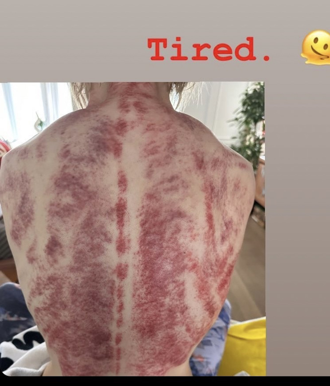 郑秀文以限时动态的方式分享她背部的模样。(图／翻摄自郑秀文IG@ sammi_chengsauman)