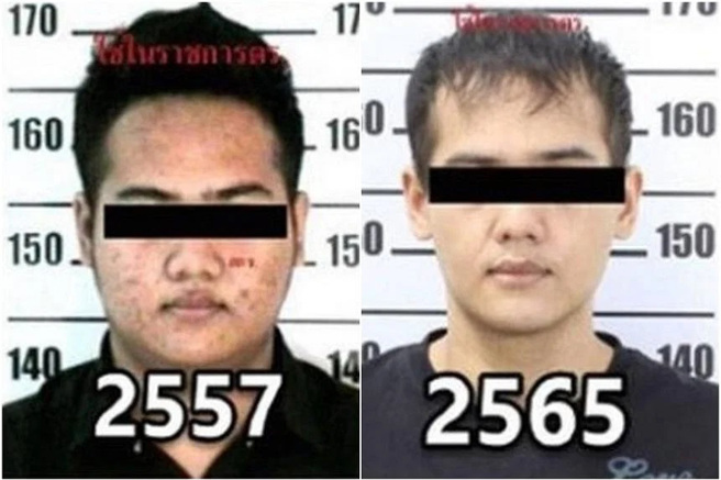 25岁的毒贩以整型来避过警方调查，在警方确认他身分后，惊讶他已经「变了个人」。(图/泰国警方)