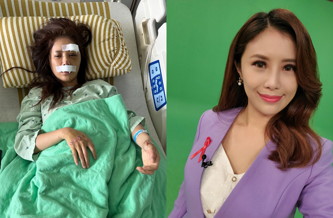 宋燕旻去年发生严重车祸。（图／宋燕旻facebook）