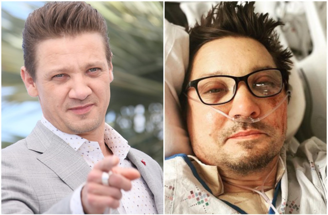 傑瑞米雷納遭鏟雪車輾過送醫，診斷後發現30多根骨頭斷裂。（圖／圖／shutterstock、jeremyrenner IG）	