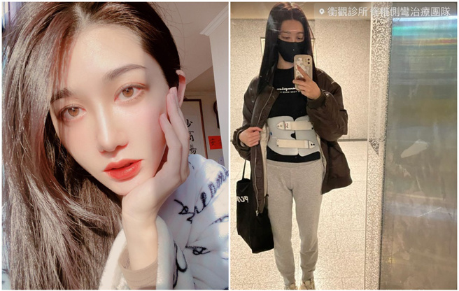 王晴表示脊椎目前正在復健，其他地方都很健康。（图／IG@ serena_wang_qing）