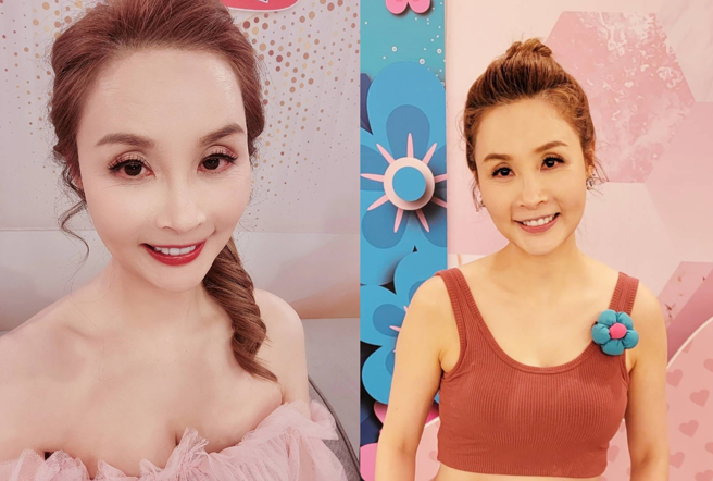 许圣梅两个月前因摔倒骨折。(图/许圣梅脸书)