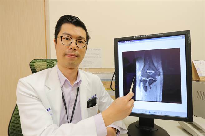 亚洲大学附属医院运动医学暨手外科主任赖禹呈指出，「网球肘」患者大多是工作需要长时间提起手腕，甚至文书工作中打字姿势不正确也可能引起，成为常见的文明病。（亚大附医提供／潘虹恩台中传真）