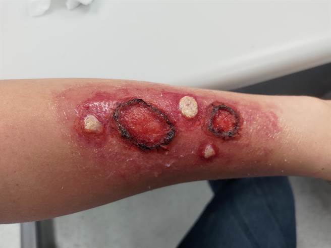 北市消防局邀请专业的「特效化妆师」，透过特殊的化妆手法，创造出各式拟真的伤妆，进而体现高拟真创伤情境。（消防局提供）