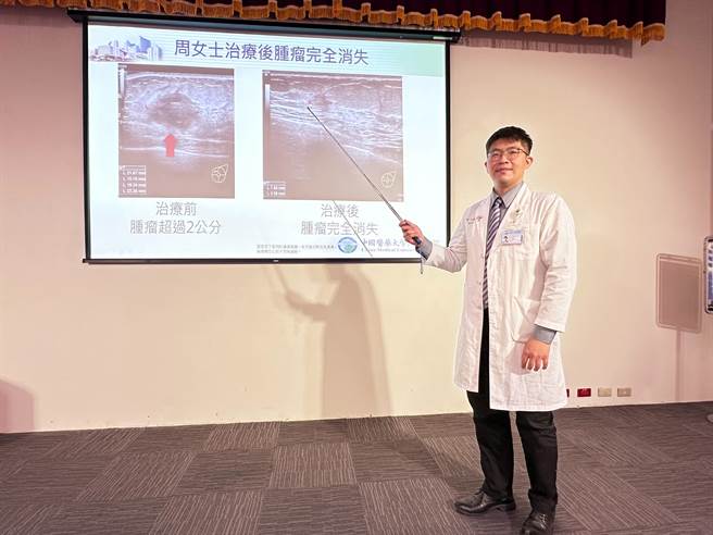 中国附医乳房外科医师黄至豪指出，孕中乳癌的病人有17％~48％属于「三阴性乳癌」，只要配合乳房跨专科团队，勇敢面对积极治疗，就有机会像周女士一样在积极治疗后母子健康平安。(中国附医提供／冯惠宜台中传真)