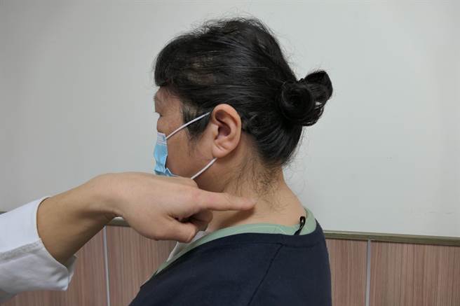 现代人经常低头滑手机造成脖子后面出现一坨肉，俗称「富贵包」。（张朝欣摄）