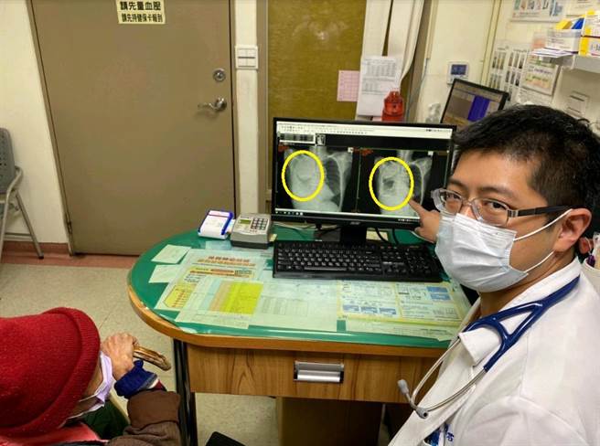 7旬徐姓妇人罹患末期肺癌，靠健保口服标靶药物抗癌已达4年。（丰原医院提供）