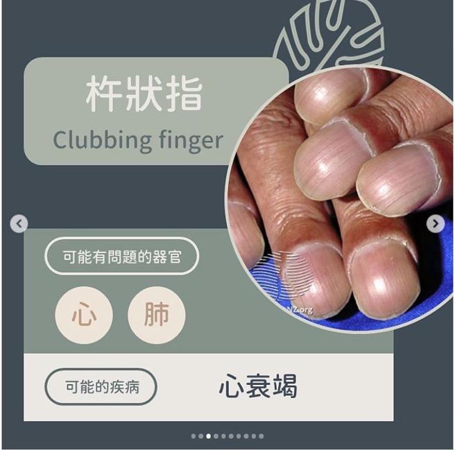 杵状指。(图/ 黄晨昊授权提供)