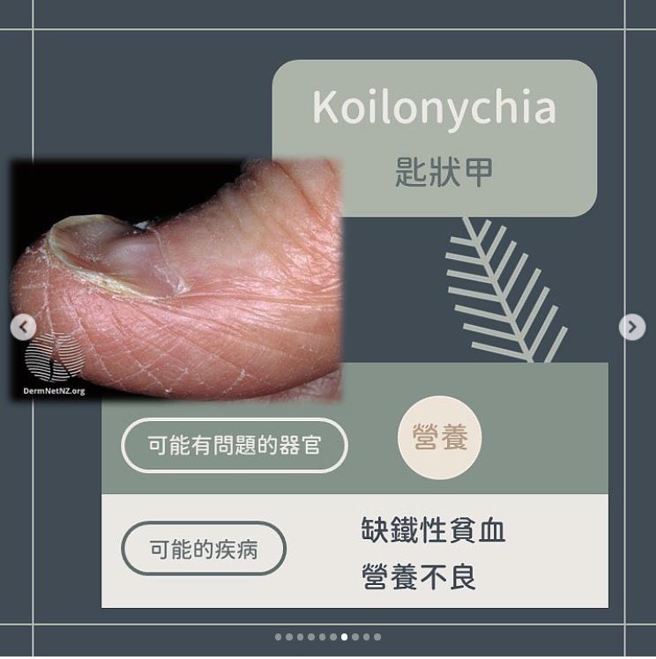 匙状甲。（图／黄晨昊授权提供）