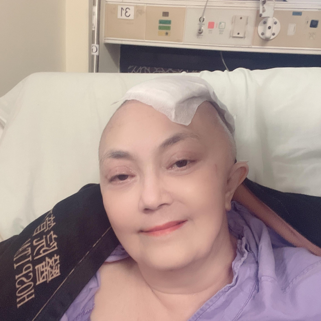 施明晒出手术后近照。（图／翻摄自施明脸书）