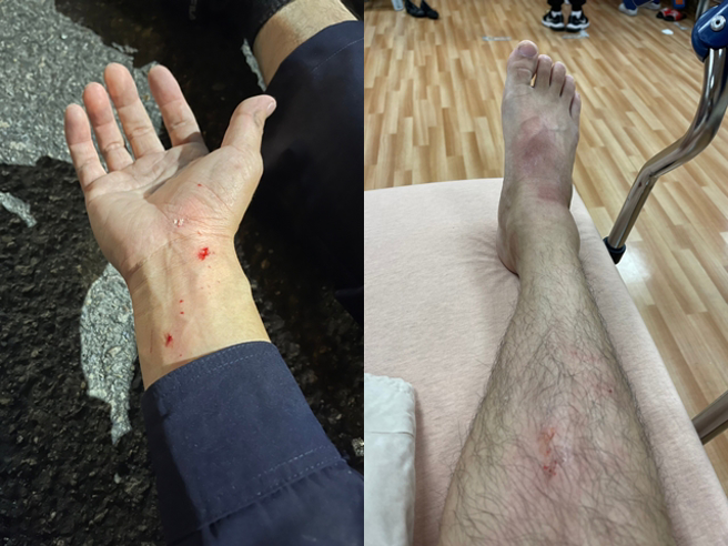 警方发现该男子是名通缉犯，追查车辆后并上前盘查，没想到男子原先假意配合，却趁警方不注意时开车加速逃逸。（警方提供）