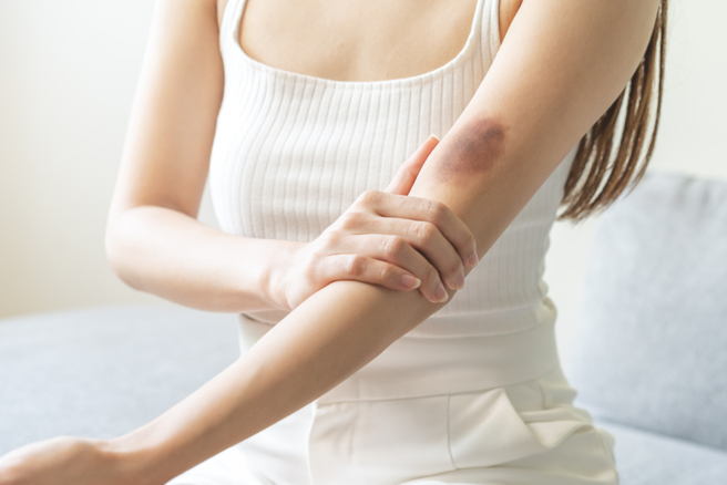 医师提醒，如出现不明原因的贫血、瘀青、疲倦，务必尽速就医。（示意图／Shutterstock）
