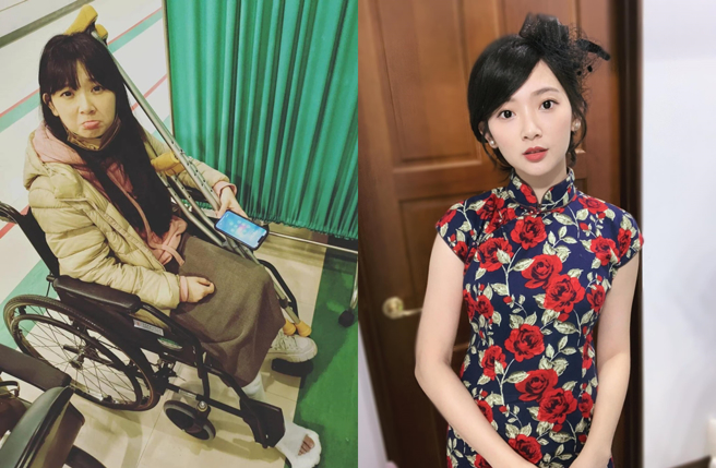 优格姐姐透露回诊时医生说要挖骨。（图／翻摄优格 - Doremi姐姐facebook）