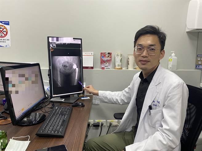 长安医院骨科医师赵子镕指出，林女士双侧都患有髋关节发育不良，左侧的髋关节软骨严重磨损，关节间隙几乎完全丧失。（冯惠宜摄）