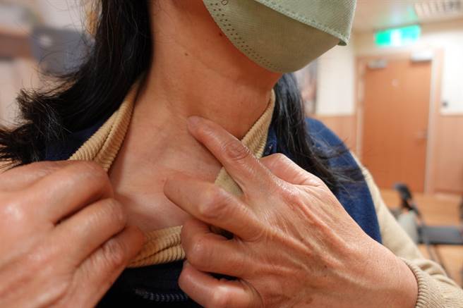 婦人手指注射羊膜基質生長因子位置。（台中慈濟醫院提供／陳淑娥台中傳真）