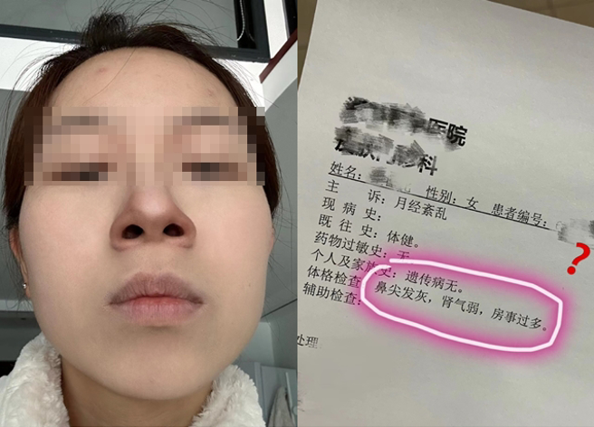 女子和媽媽去看中醫，老中醫師看了她「鼻頭發灰」，後來也提醒「腎氣弱房事過多」，然而，她看了自己鼻子後卻哭笑不得。（翻攝自微博）