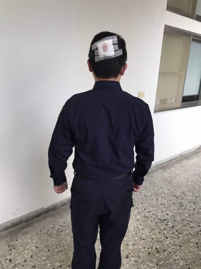受伤员警头部及身体多处擦伤。（警方提供／曹婷婷台南传真）