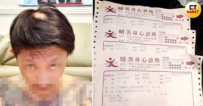 在官司審理期間，林男出現鬼剃頭、失眠、幻覺等現象，林妻目前也在精神科就診。（圖／投訴人提供）