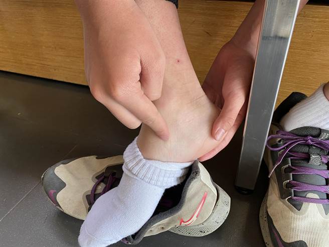 嘉义陈姓家长控诉儿子在学校宿舍遭霸凌，脚踝受伤。（廖素慧摄）