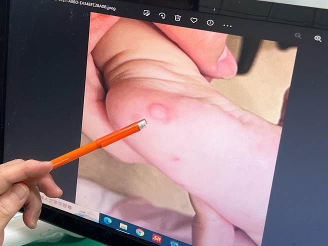 苗栗县苑里镇里仁诊所最近收到不少幼稚园学童染肠病毒的案例，医师提醒要勤洗手。（苑里李综合医院提供／谢明俊苗栗传真）