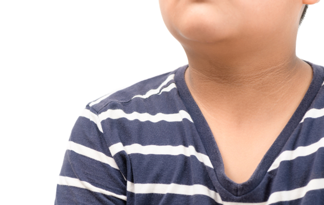 脖子太粗或是颈部后方推积太多脂肪，糖尿病及心血管疾病风险将增加2至6倍。（示意图／Shutterstock）