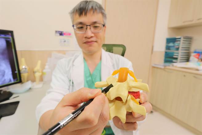 亚洲大学附属医院骨科主治医师罗达富指出，「正中线微创脊椎融合手术」，除可减少传统手术伤口的一半大小，也降低背部肌肉牵拉的损伤，将骨钉植入的方向与神经根相反，可减少神经损伤的机会。（亚大附医提供／潘虹恩台中传真）