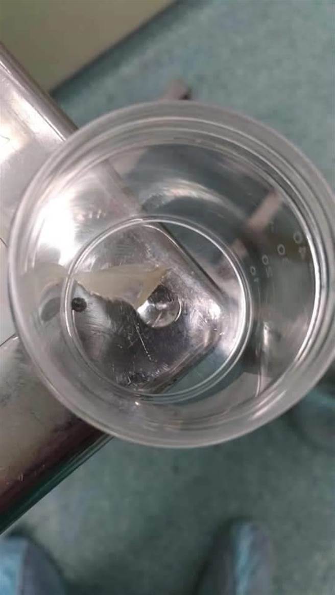 花莲一名70多岁的陈姓老翁因食道卡了2公分的鱼刺，深夜感到喉咙不适，后经医师进行食道镜手术取出后，解决鱼刺卡喉危机。（花莲慈济医院提供／罗亦晽花莲传真）