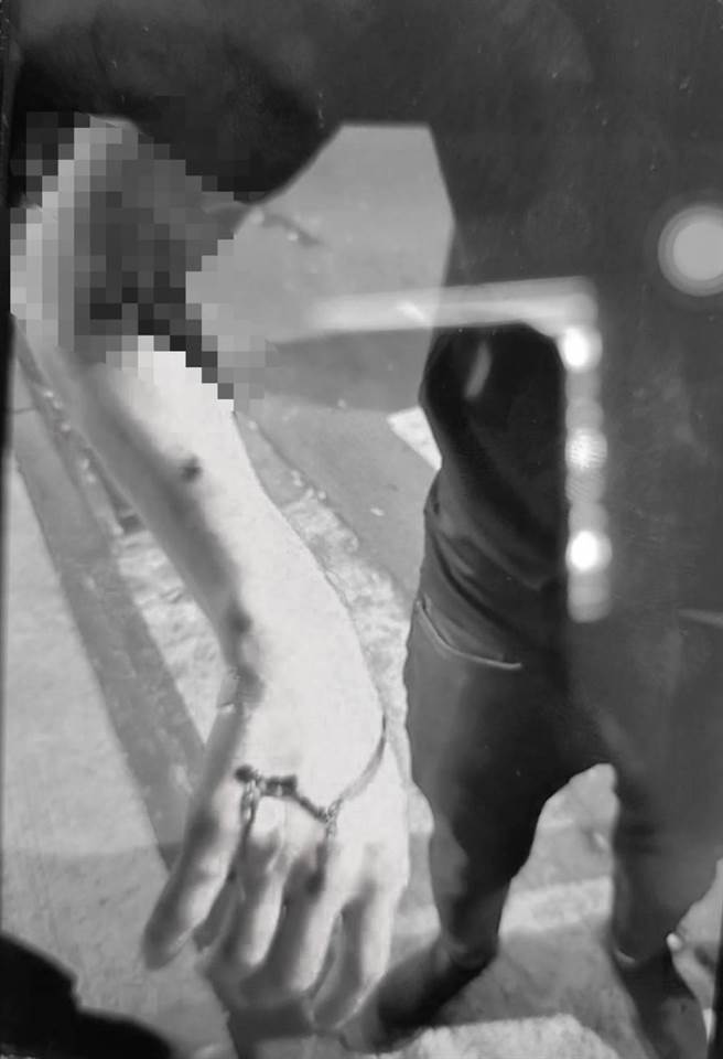 林姓男子右手留下打破宾士玻璃的伤痕。（翻摄画面）