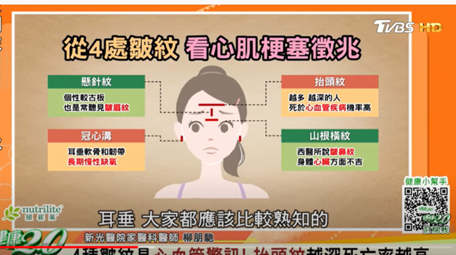 从4处皱纹看心臟徵兆。(图/取自《健康2.0》YouTube)
