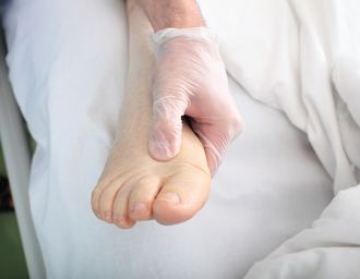 腳腫是腎臟出問題？ 醫：單腳跟雙腳病因不同