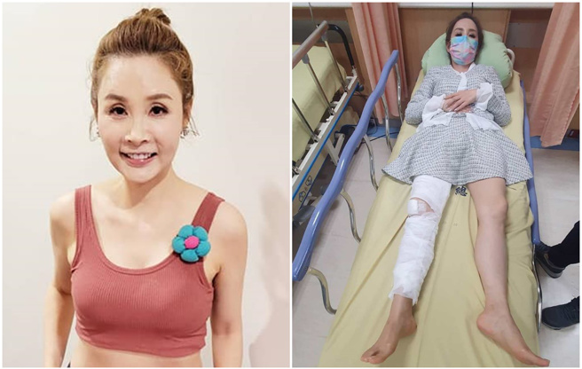 许圣梅1月惨摔。（图／许圣梅脸书）