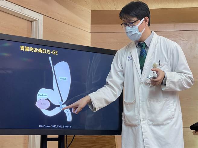 台东马偕胃肠肝胆科医师吴佳宪。（蔡旻妤摄）