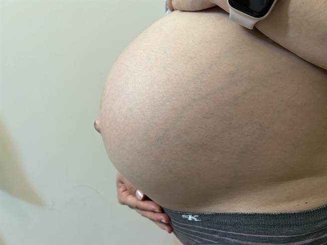 产后忧郁症妥善治癒，2周内开始改善。(蔡依珍摄)