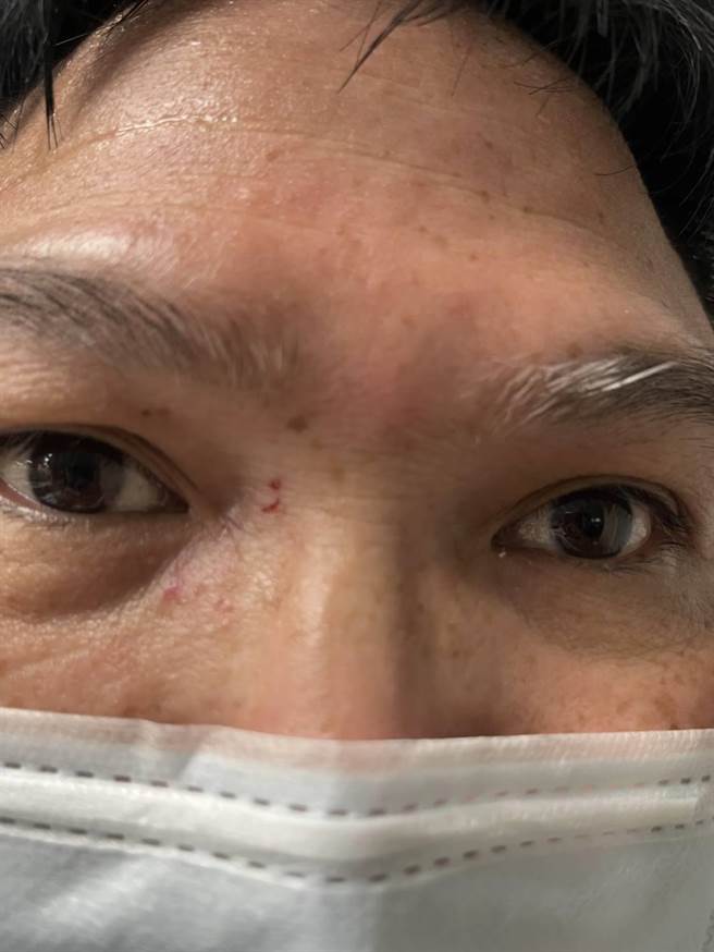 49岁徐姓醉男国骂辱警，还抓伤警察眼角和打飞眼镜。(翻摄照片／蔡依珍桃园传真)