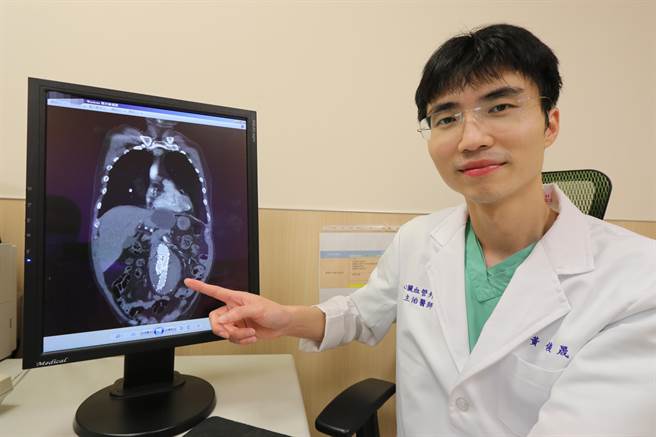 亚洲大学附属医院心臟血管外科主治医师黄俊晟指出，主动脉剥离或腹主动脉瘤几乎没有任何预兆，前者发作时会有刀割撕裂般的胸、背痛，后者则会摸到凸出血管或出现痛感。（亚大附医提供／潘虹恩台中传真）