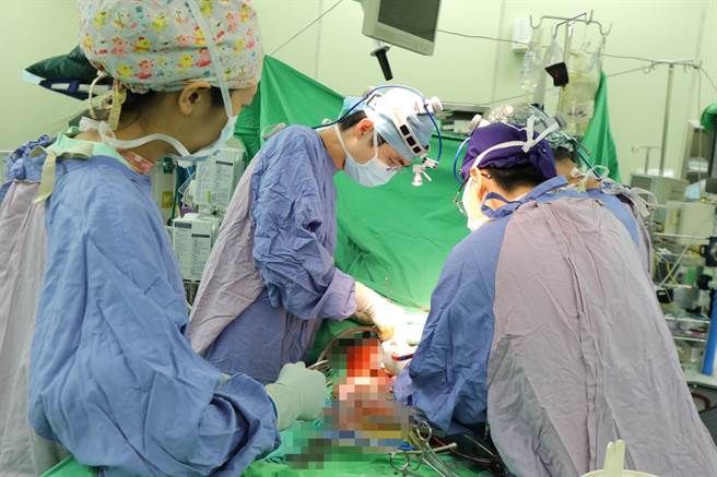 菸龄50多年黄姓老翁长出直径8公分的腹主动脉瘤以及明显主动脉弓剥离，所幸紧急安排微创主动脉覆膜支架手术后成功恢復。（亚大附医提供／潘虹恩台中传真）