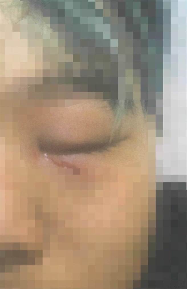 被害人不从便遭诈骗集团殴打凌虐。（本报资料照）