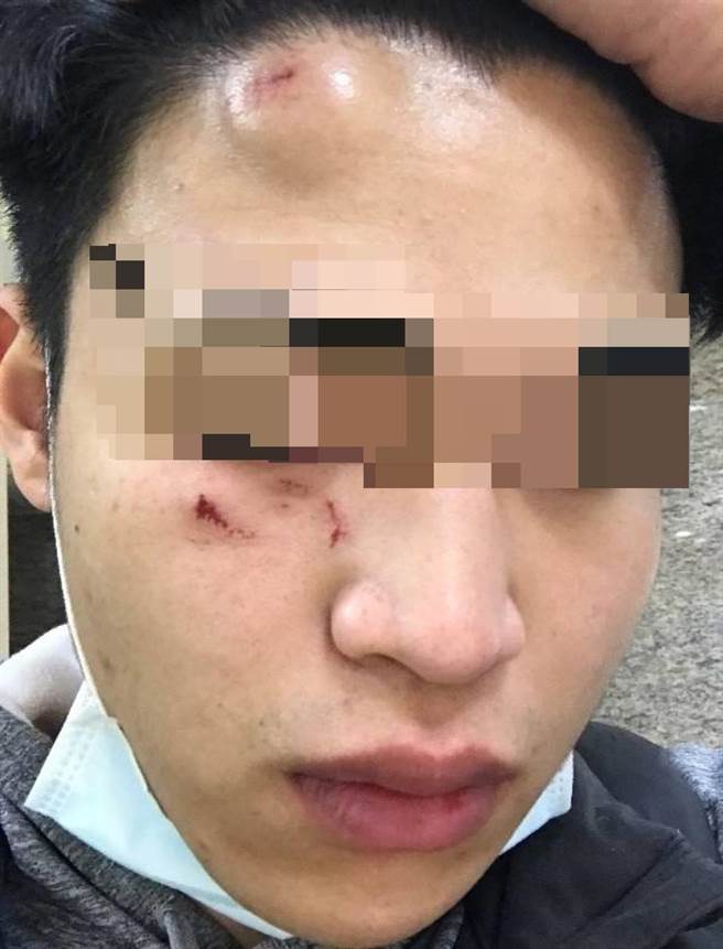 梁男遭拘禁控制，还被打得全身是伤。（警方提供）