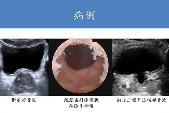 手术前后比较图。（书田诊所提供）