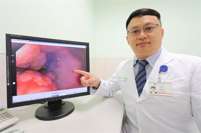 亚洲大学附属医院胸腔外科主治医师刘柏毅表示，民眾有抽菸、喝酒、吃槟榔等，万一察觉有吞咽困难、喉咙卡卡等，建议尽快就医评估。（亚大附医提供／潘虹恩台中传真）