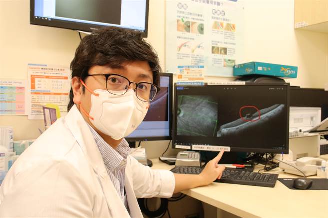 张耘嘉医师指出，黄斑部牵扯症与白内障病人在身上的感受上相似，因此需要更精密的检查。（辅大医院提供）