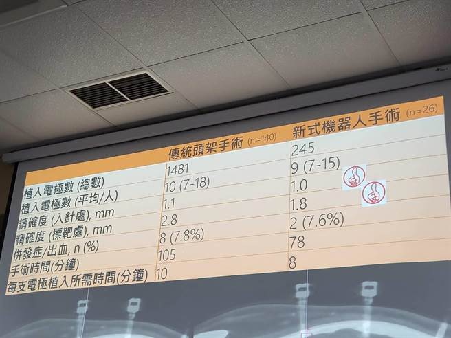 藉由手术机器人辅助治疗癫痫，无论是精准度或是安全性都远优于传统开颅手术。（陈人齐摄）