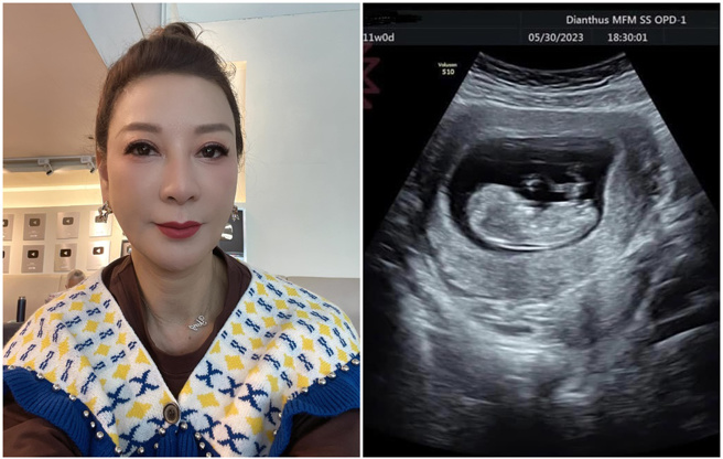 杨绣惠2天前PO超音波照，网友看得又惊又喜。（图／FB@杨绣惠）