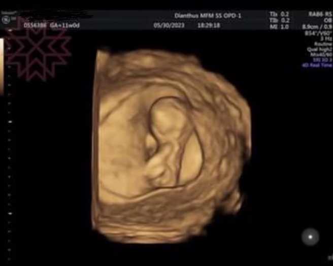 杨绣惠PO超音波照求恭喜。（图／FB@杨绣惠）